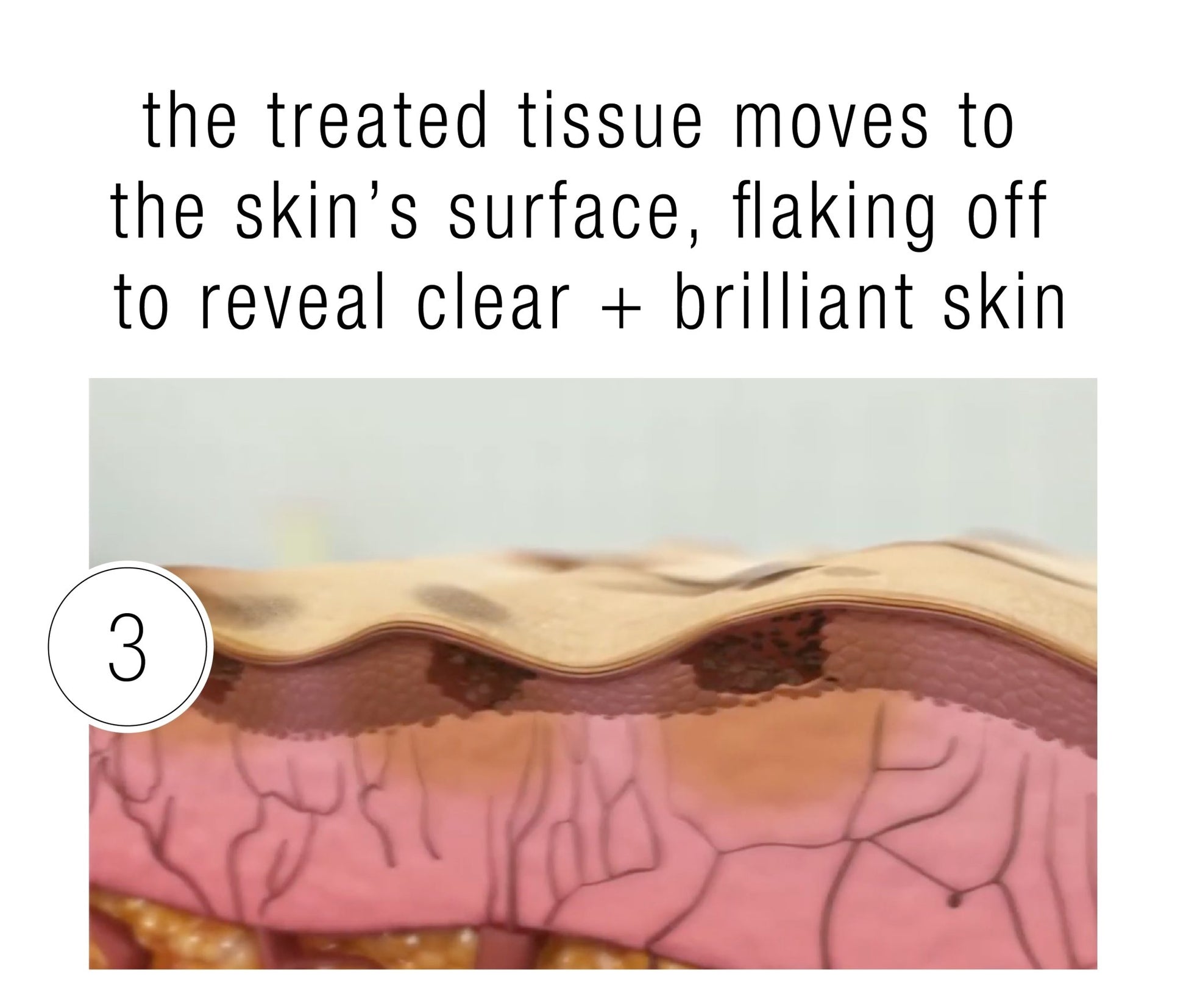 Clear + Brilliant - Skinney Medspa Services