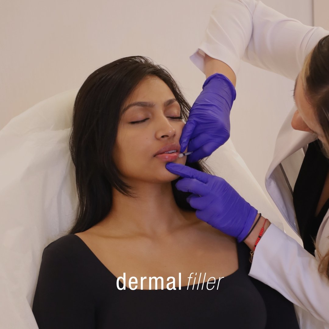 Dermal Filler - Skinney Medspa Services