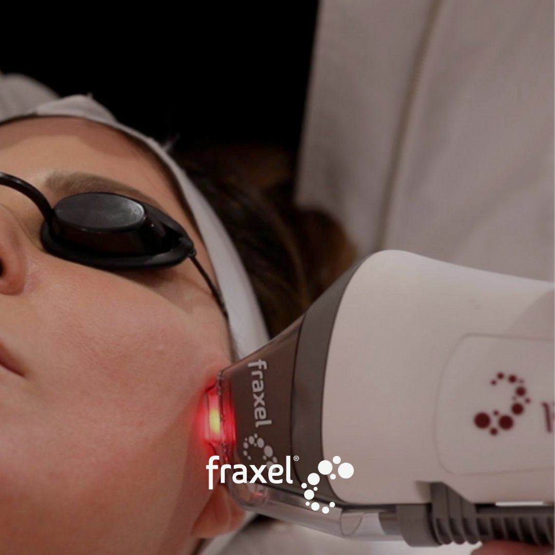 Fraxel Dual - Skinney Medspa Services