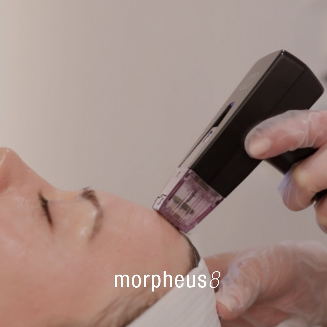 Morpheus 8 - Skinney Medspa Services