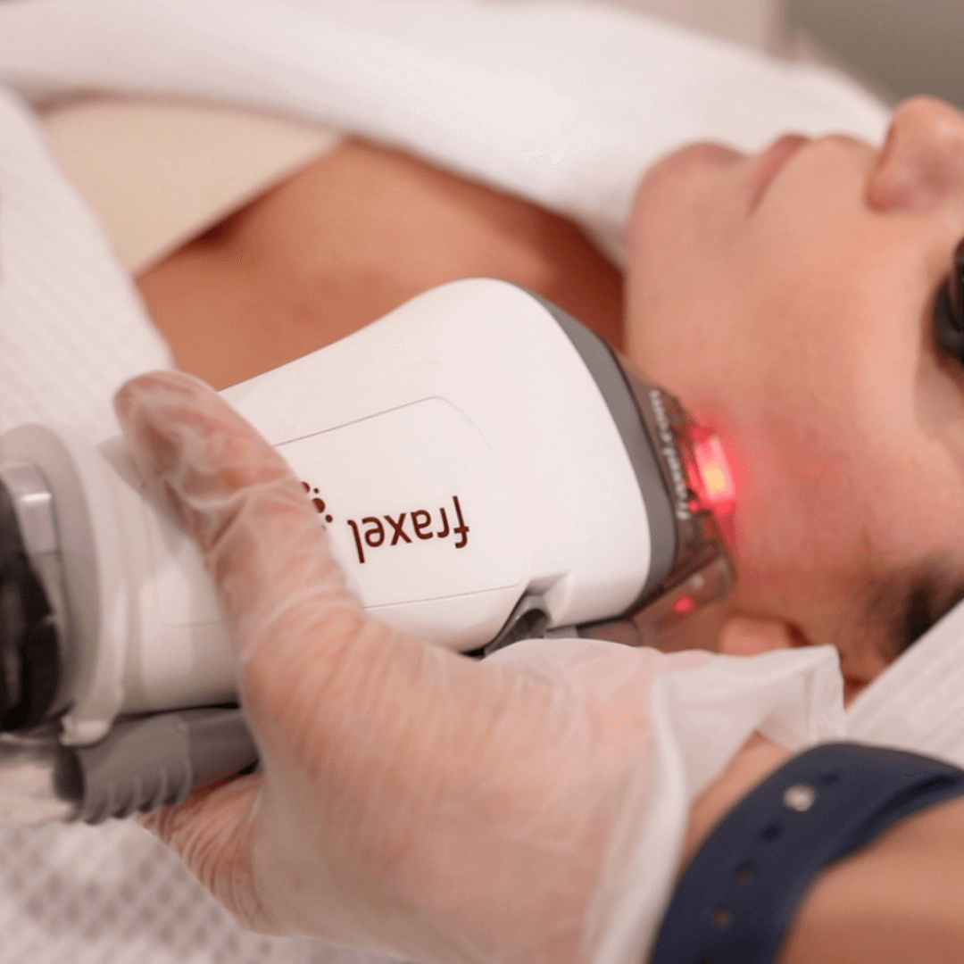 Fraxel Dual (NYC Locations Only)