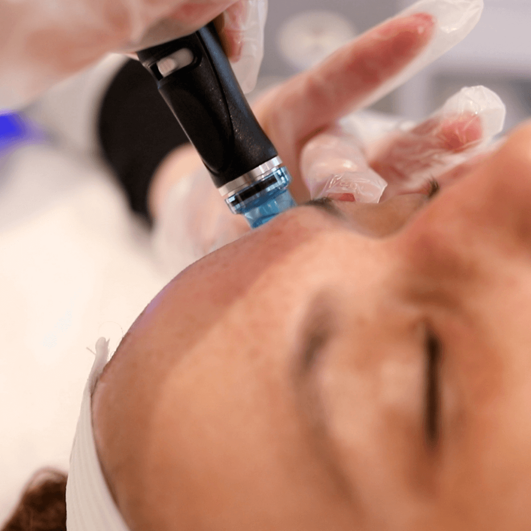 HydraFacial