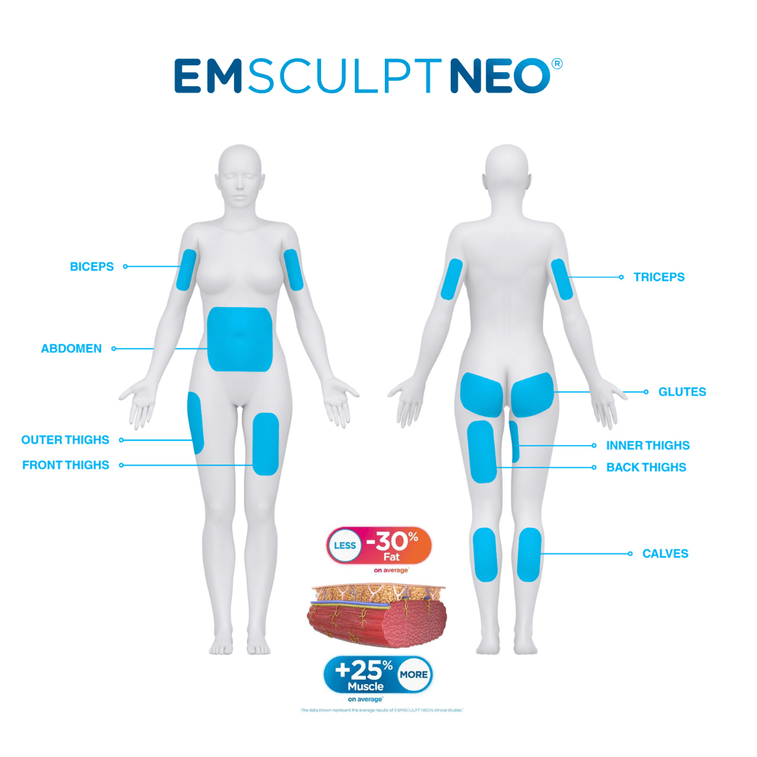 Emsculpt NEO (NYC Locations Only)