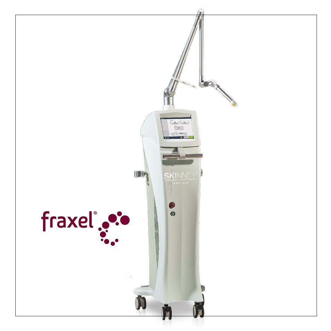 Fraxel (Single Session) - SKINNEY Medspa Treatments