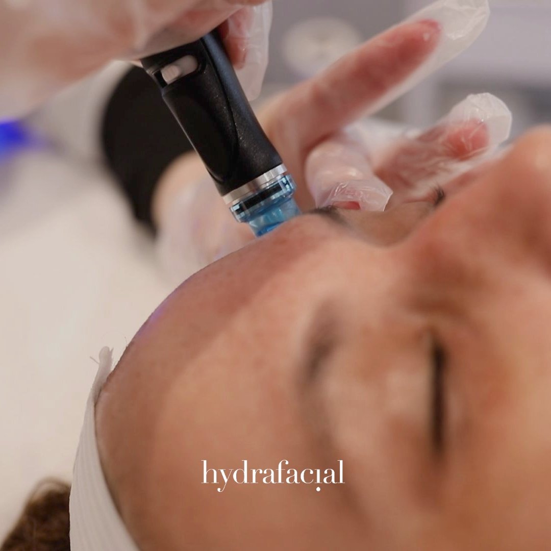 HydraFacial - Skinney Medspa Services