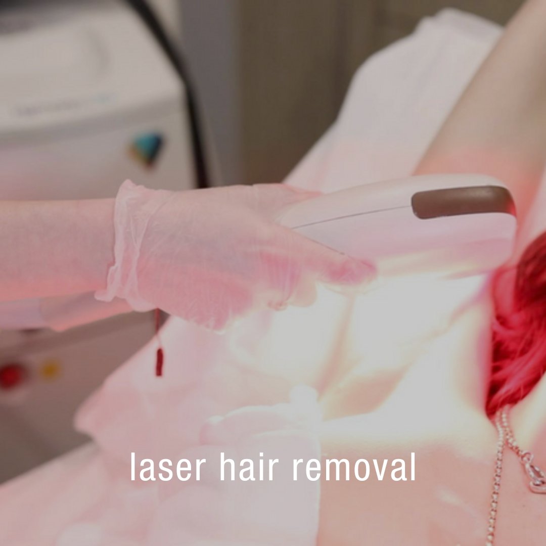 Laser Hair Removal - Skinney Medspa Services